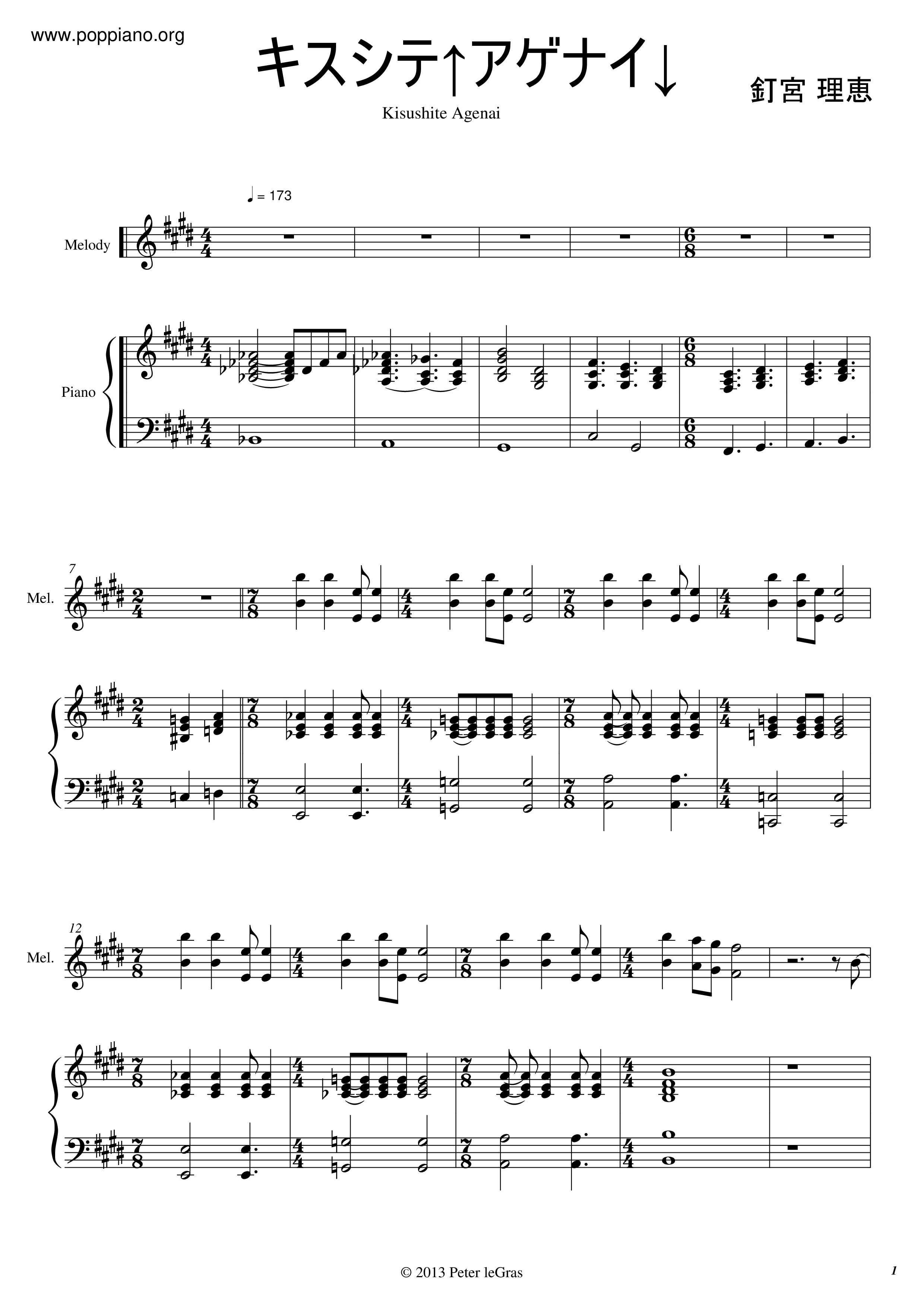 Kiss Shite Agenai Score